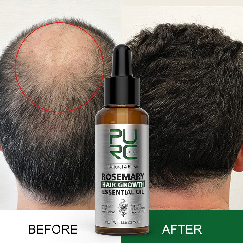 Sérum Capillaire Romarin & Gingembre